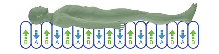 What Is Static Mode for Hospital Air Mattress